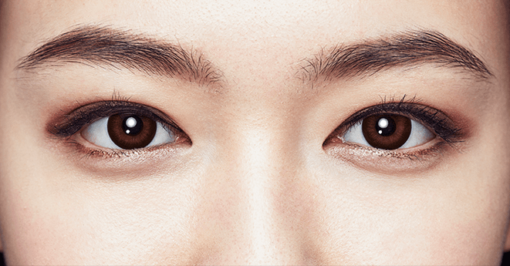 1 Day Acuvue Define Radiant Charm lenses are worn, showing eye enhancement