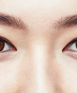 1 Day Acuvue Define Radiant Charm lenses are worn, showing eye enhancement