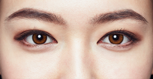 1 Day Acuvue Define Radiant Charm lenses are worn, showing eye enhancement