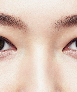 1 Day Acuvue Define Radiant Charm lenses are worn, showing eye enhancement