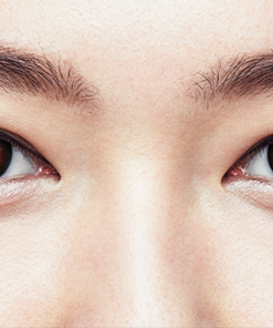 1 Day Acuvue Define Accent Style lenses are worn, showing eye enhancement